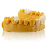 SLA Nano-Ceramic Hybrid Composite Crowns SLA Nano-Ceramic Hybrid Composite Crowns