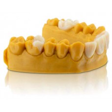 SLA Nano-Ceramic Hybrid Composite Crowns