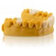 SLA Nano-Ceramic Hybrid Composite Crowns